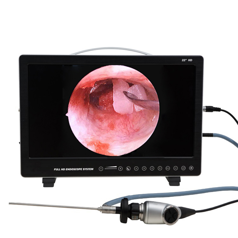 Laptop Accessories All In One - 22 Inch Endoscoop Camera Systeem 80W